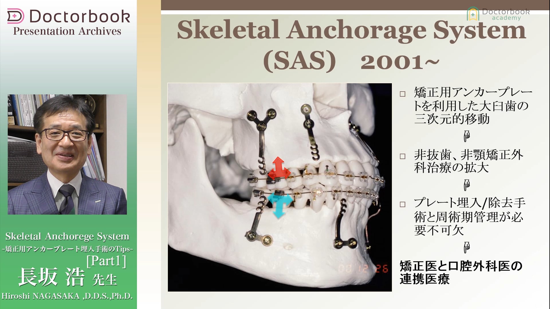 #1 Skeletal Anchorage Systemについて