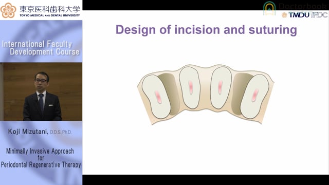 Minimally Invasive Approach for Periodontal Regenerative Therapy