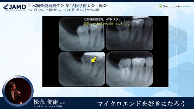 第15回 日本顕微鏡歯科学会 学術大会