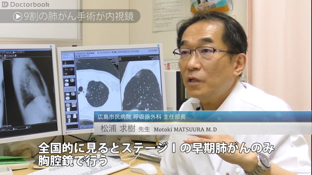 肺がんの内視鏡手術（胸腔鏡手術）とは？