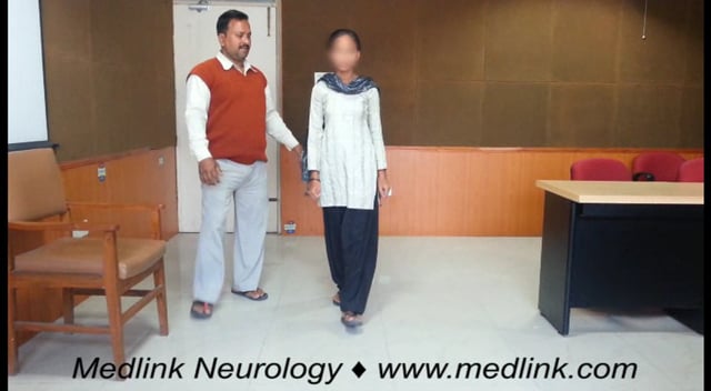 Subacute sclerosing panencephalitis: subtle myoclonus (2)