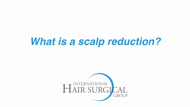 What is Scalp Reduction for Baldness | John Schwinning, MD
