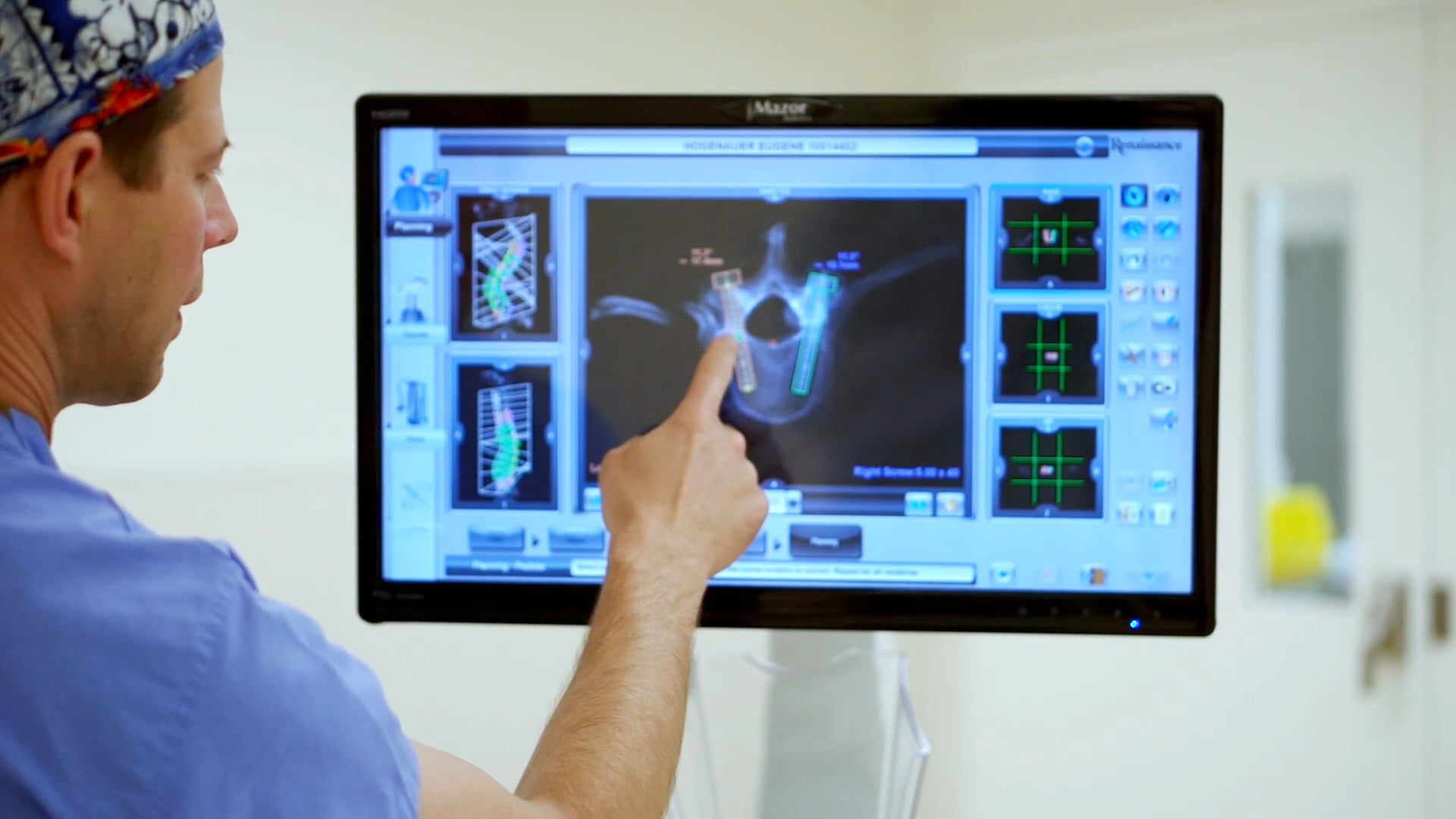 Mazor Robotics Renaissance® Guidance System | Videos & Movies on Vimeo