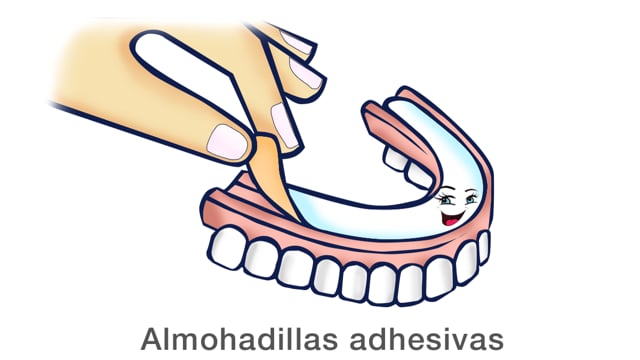 Almohadillas adhesivas