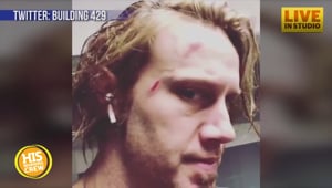 Ouch! Jason Roy of Building 429 Injured by Closet Shelf