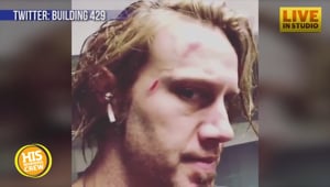 Ouch! Jason Roy of Building 429 Injured by Closet Shelf