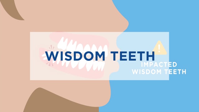 Wisdom Teeth: Impacted (:15)