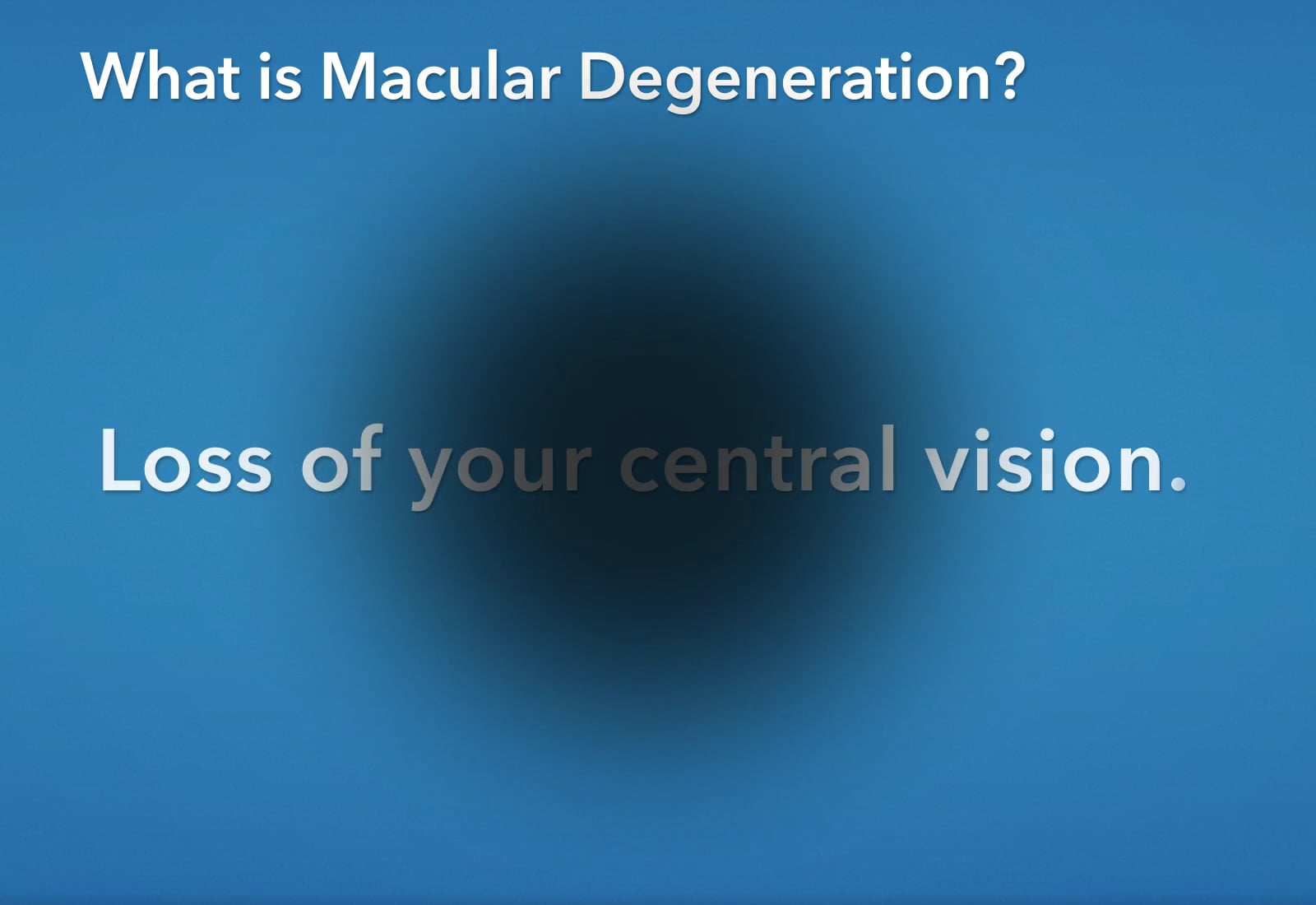 Macular Degeneration What is Macular Degeneration? on Vimeo