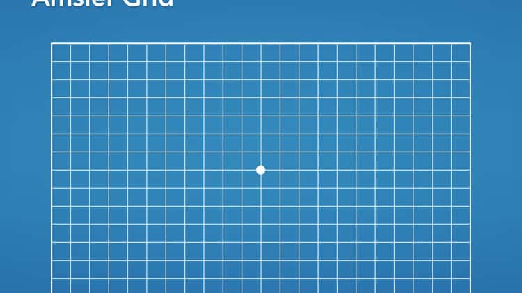 Age-related Macular Degeneration: Using The Amsler Grid — Costello Opticians
