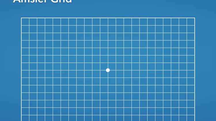 Age-related Macular Degeneration: Using The Amsler Grid — Costello Opticians