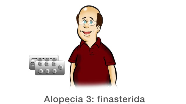 Alopecia 3: finasterida