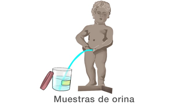 Muestras de orina