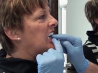 First Try in Patient Mouth