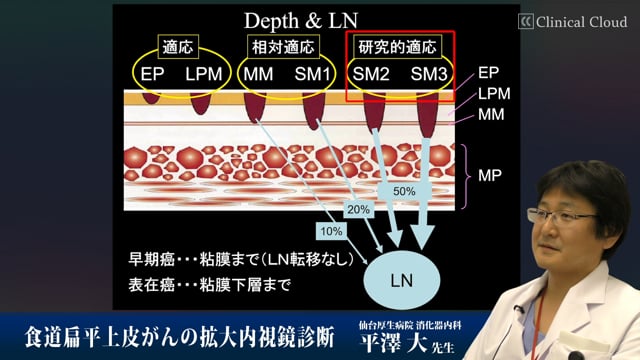 食道扁平上皮がんの拡大内視鏡診断