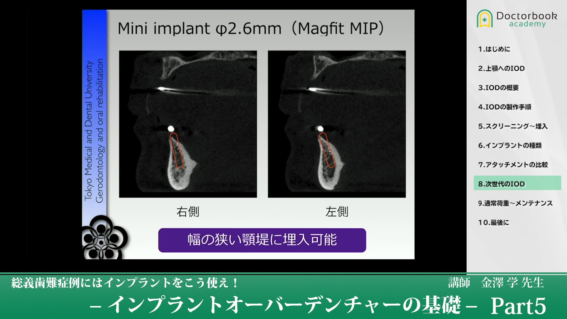 #5 次世代のIOD