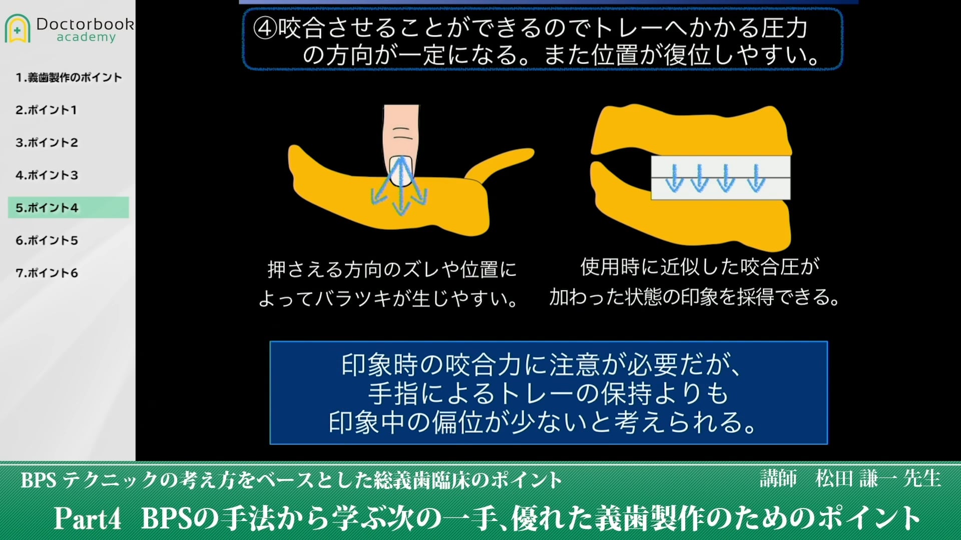 BPSの手法から学ぶ次の一手、優れた義歯製作のためのポイント #4 