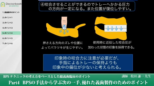 BPSの手法から学ぶ次の一手、優れた義歯製作のためのポイント #4 