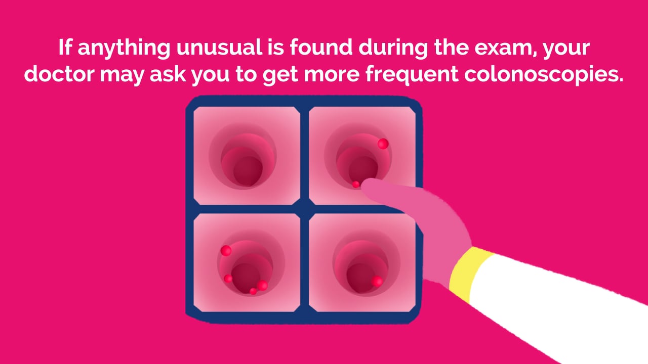 _Colonoscopy_Animation on Vimeo