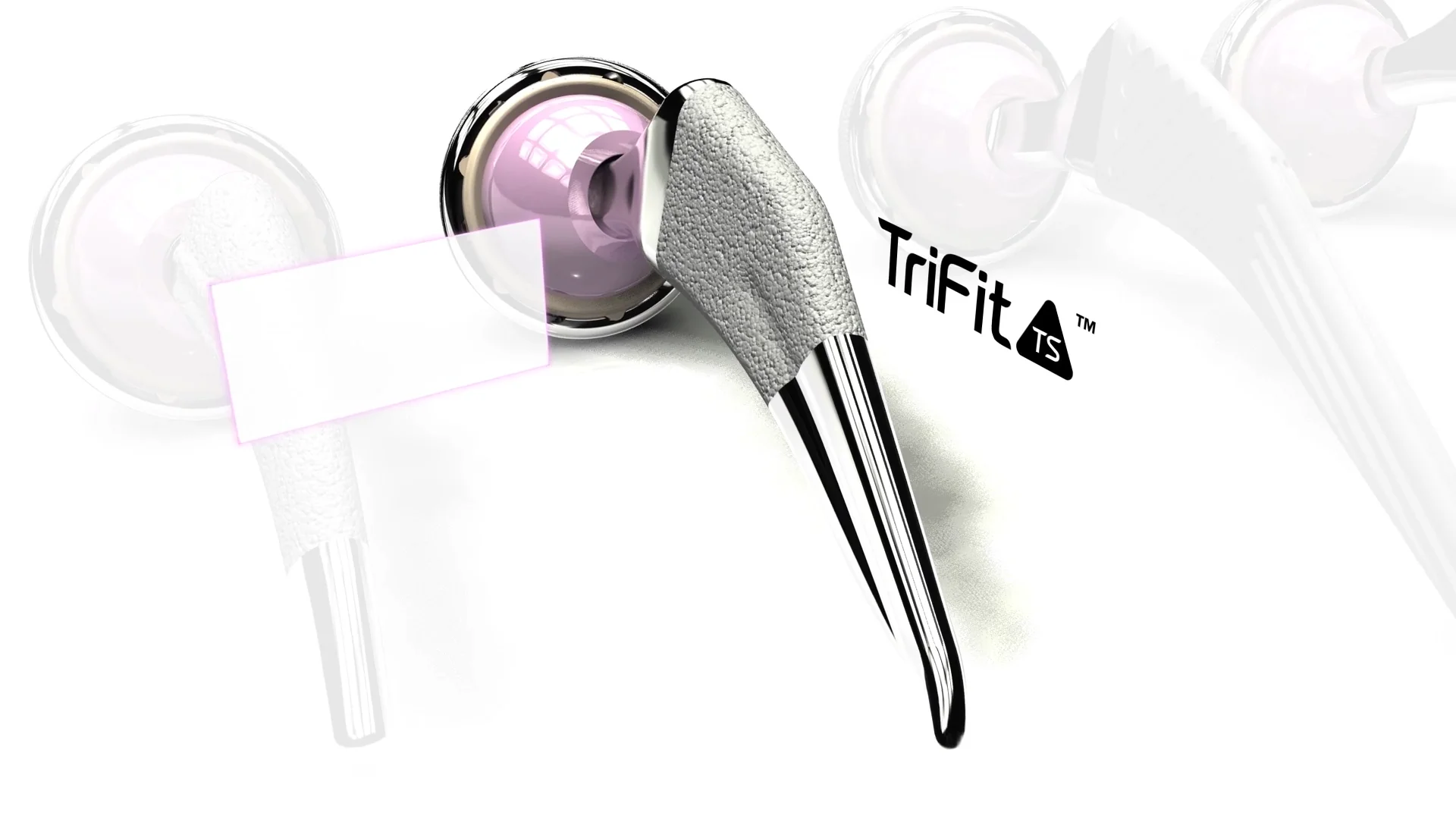 TriFit TS™ | Hip Implant Solutions | Corin Group