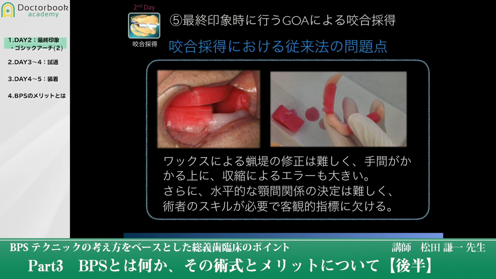 BPSとは何か、その術式とメリットについて（後半） #3 