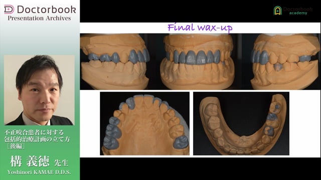 不正咬合患者に対する包括的治療計画の立て方 | Doctorbook academy