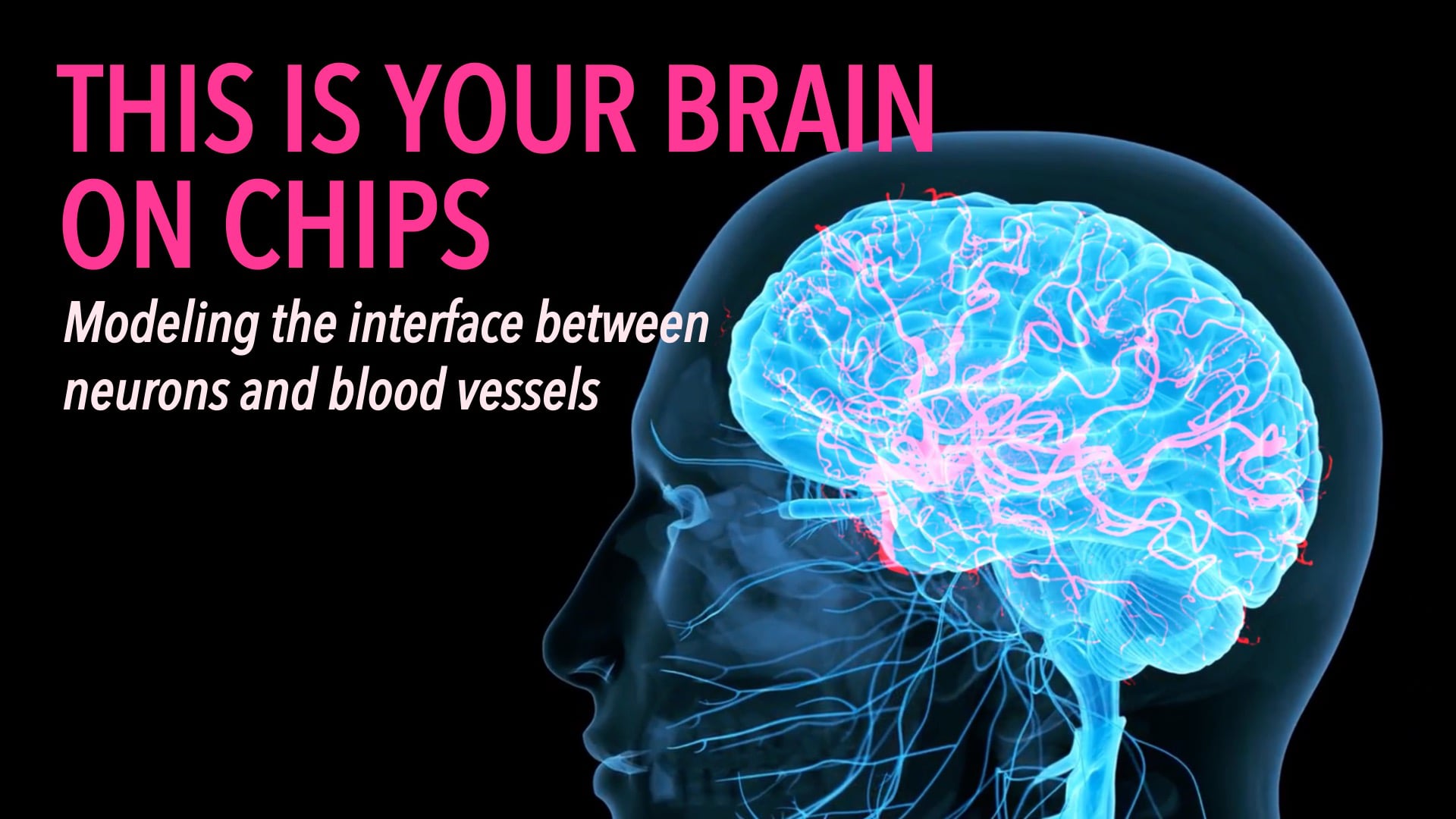 This is Your Brain on Chips