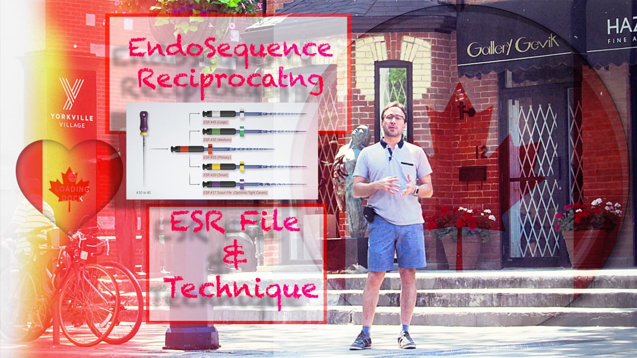 CBL 21 EndoSequence Reciprocating (ESR) File. A clinical case and