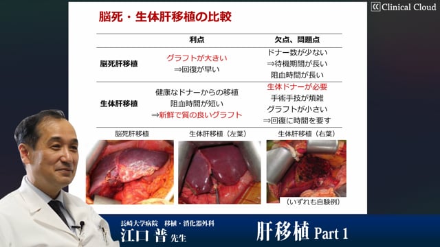 肝移植 Part1