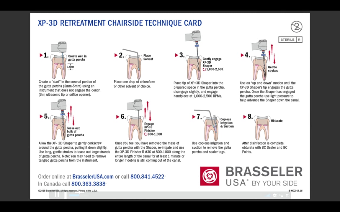 3D Instruments for RCT Retreatment (Chair Side Technique Card) Real