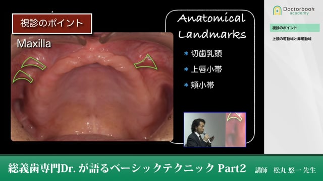 総義歯専門Dr.が語るベーシックテクニック | Doctorbook academy ...