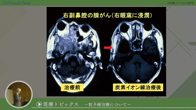 [12-3] 医師事務作業補助者研修 section12：医療トピックス-粒子線治療について-