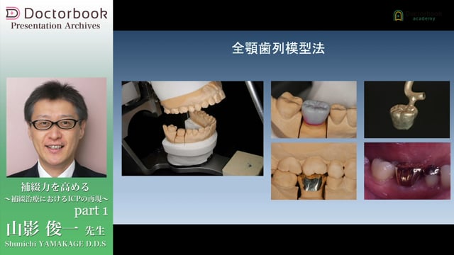 補綴力を高める 〜補綴治療におけるICPの再現〜