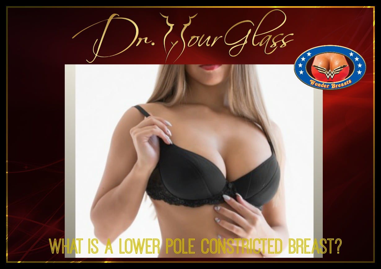 What is a lower pole constricted breast?