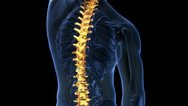 Spinal Cord Stimulator South County, Back Pain