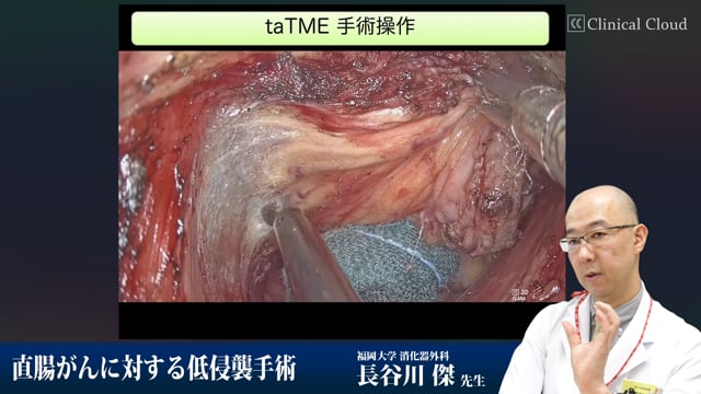  直腸がんに対する低侵襲手術 Part2