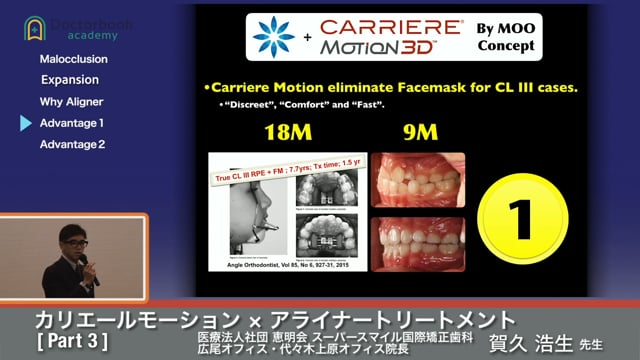 矯正歯科のトレンド ～カリエールモーション×アライナートリートメント～ #3