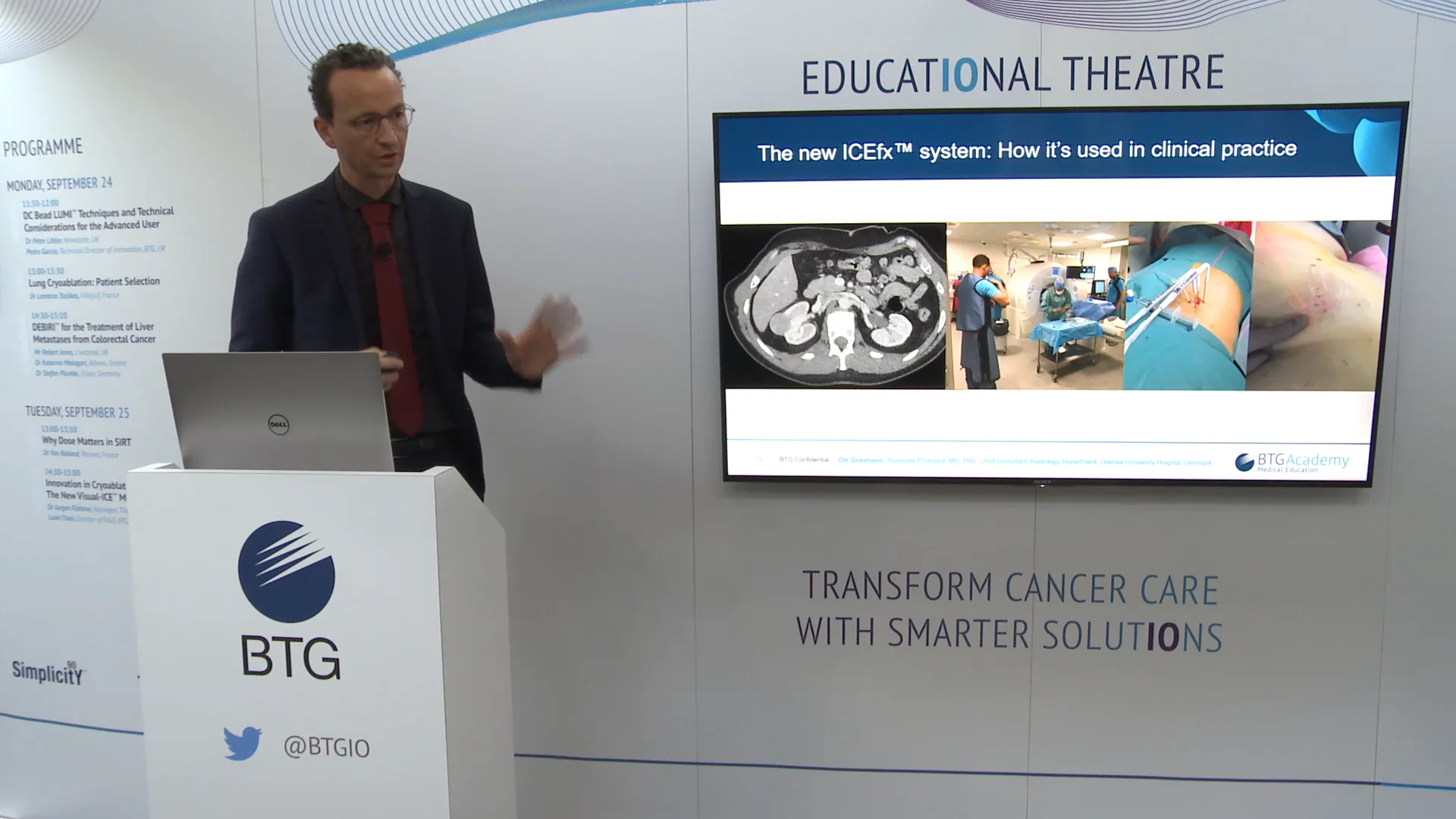 Innovation in Cryoablation - the new ICEfx System on Vimeo