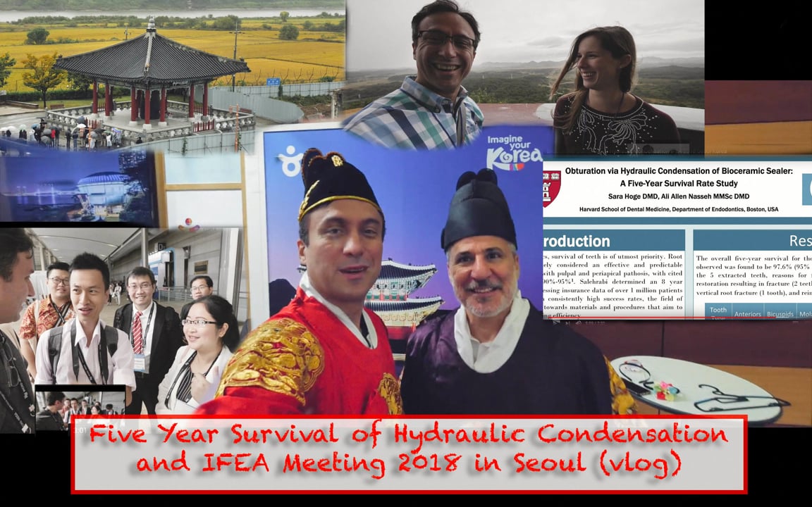 Five Year Survival of Hydraulic Condensation Cases Real World Endo