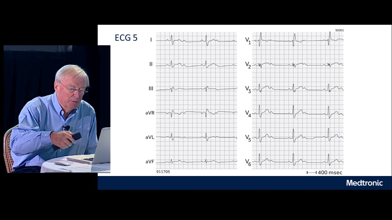 Friday Lecture - Medtronic Friday PART 1_SC 6c Brady on Vimeo