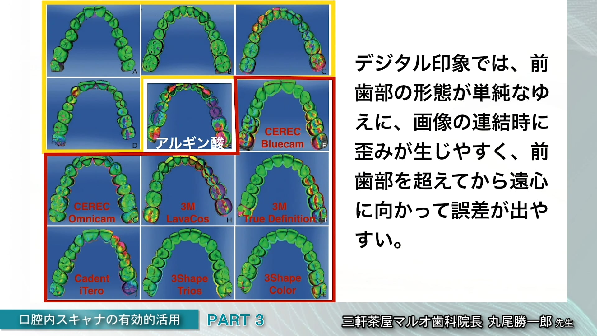 #3 複数歯におけるインプラント補綴の印象・注意点