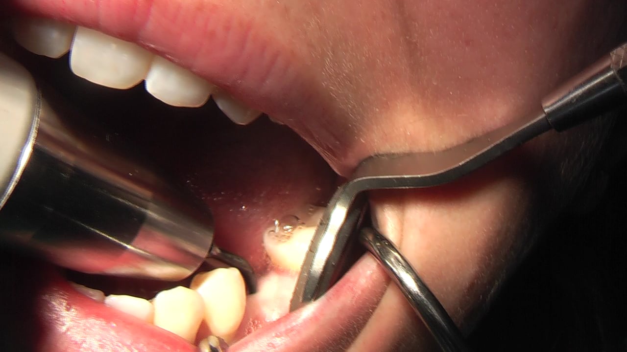 MIDI TECHNIQUE CLINICA DOCTORES REY