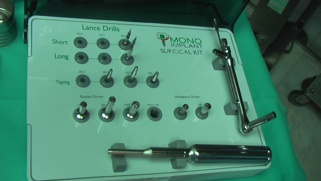 MIDI TECHNIQUE MONOIMPLANT.CLINICA DOCTORES REY VALLADOLID