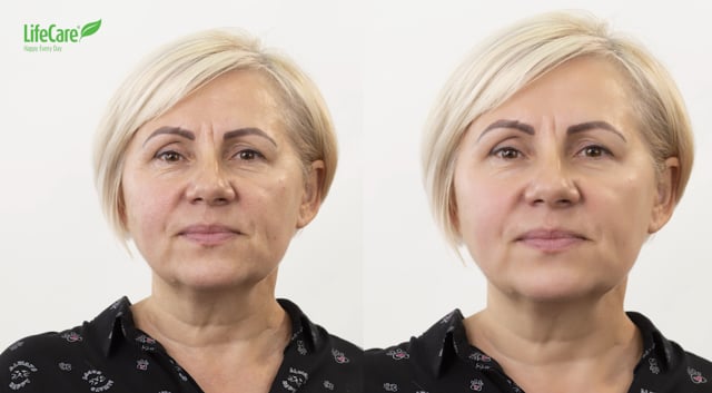 Ser antirid, Lifting Serum, Life Care®