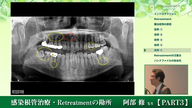 #3 CBCTの有用性