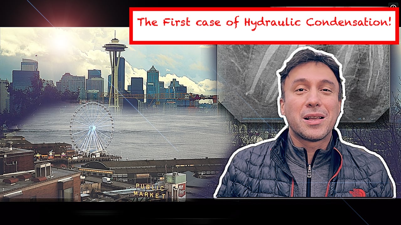 The First Case of Synchronized Hydraulic Condensation (Seattle Vlog