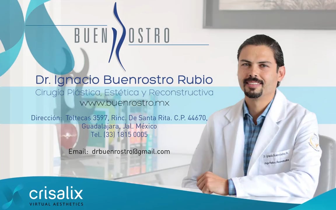 Crisalix para Pacientes Dr Ignacio Buenrostro on Vimeo