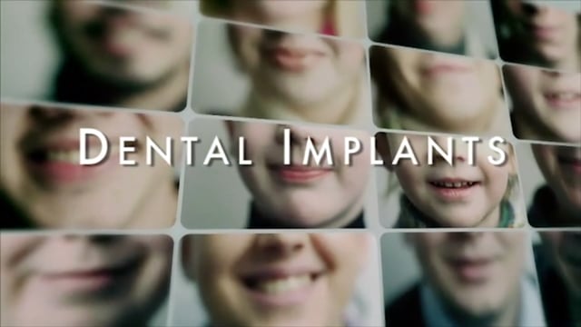 Dental Implants