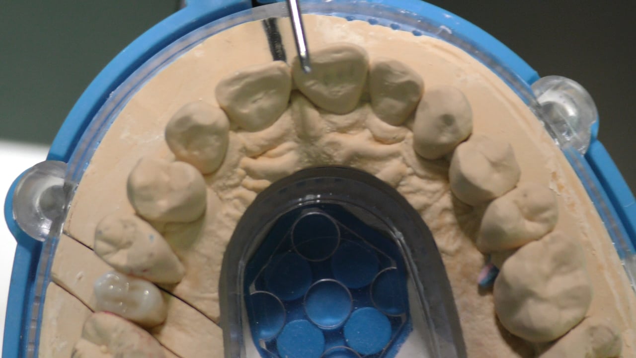 Implantes Midi technique doctores Rey