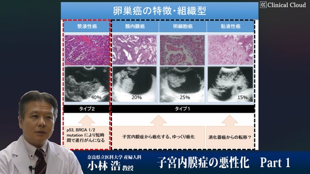 子宮内膜症の悪性化-Part1-