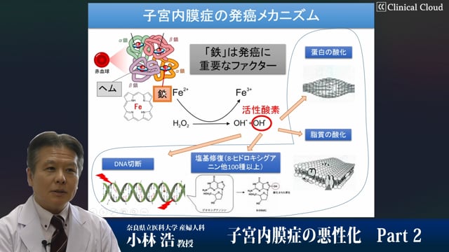 子宮内膜症の悪性化 -Part2-